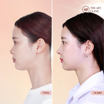 Slider image (4) The Art Clinic